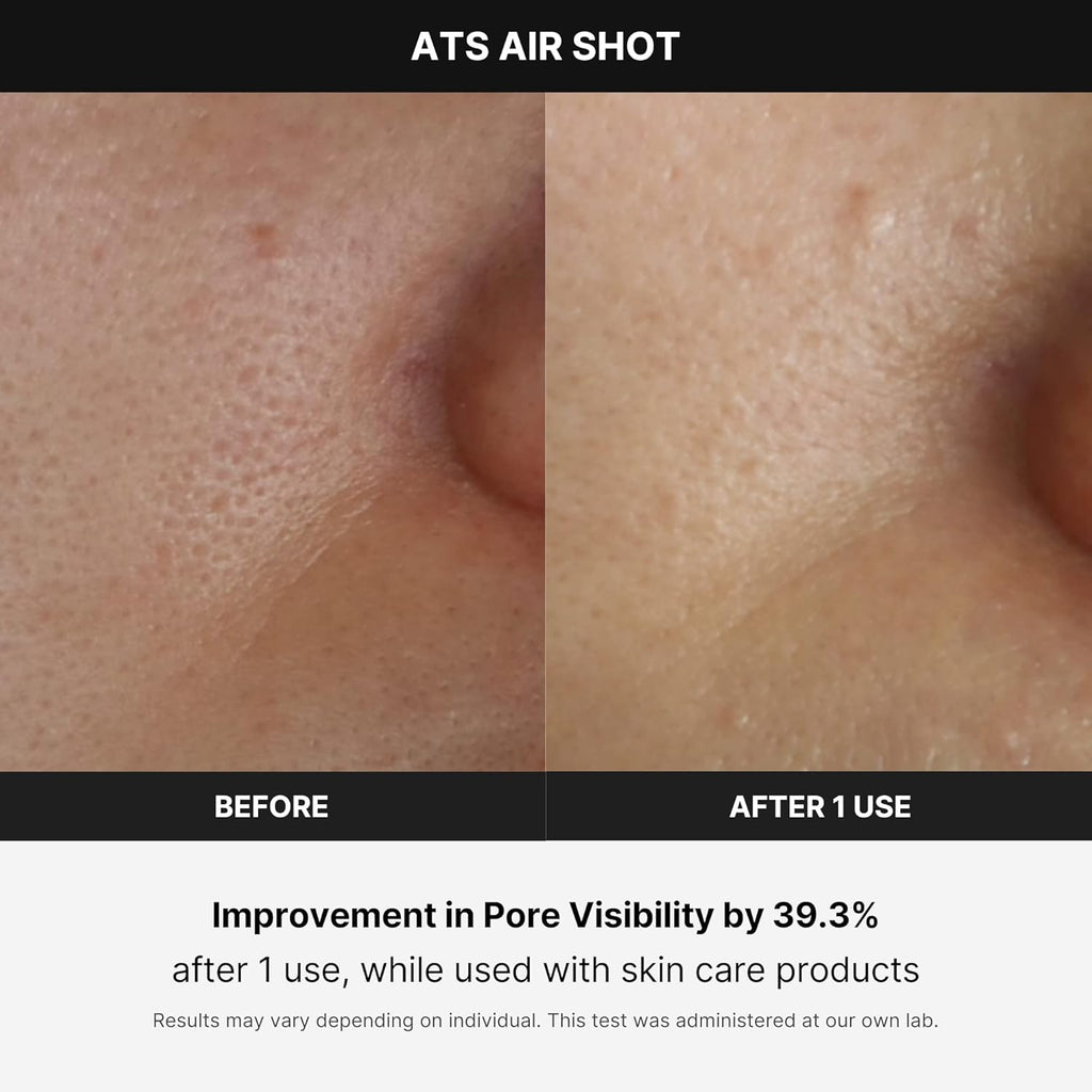 Medicube Age-R ATS Air Shot - Microneedling Pore Tightening Skin Care Device wourant