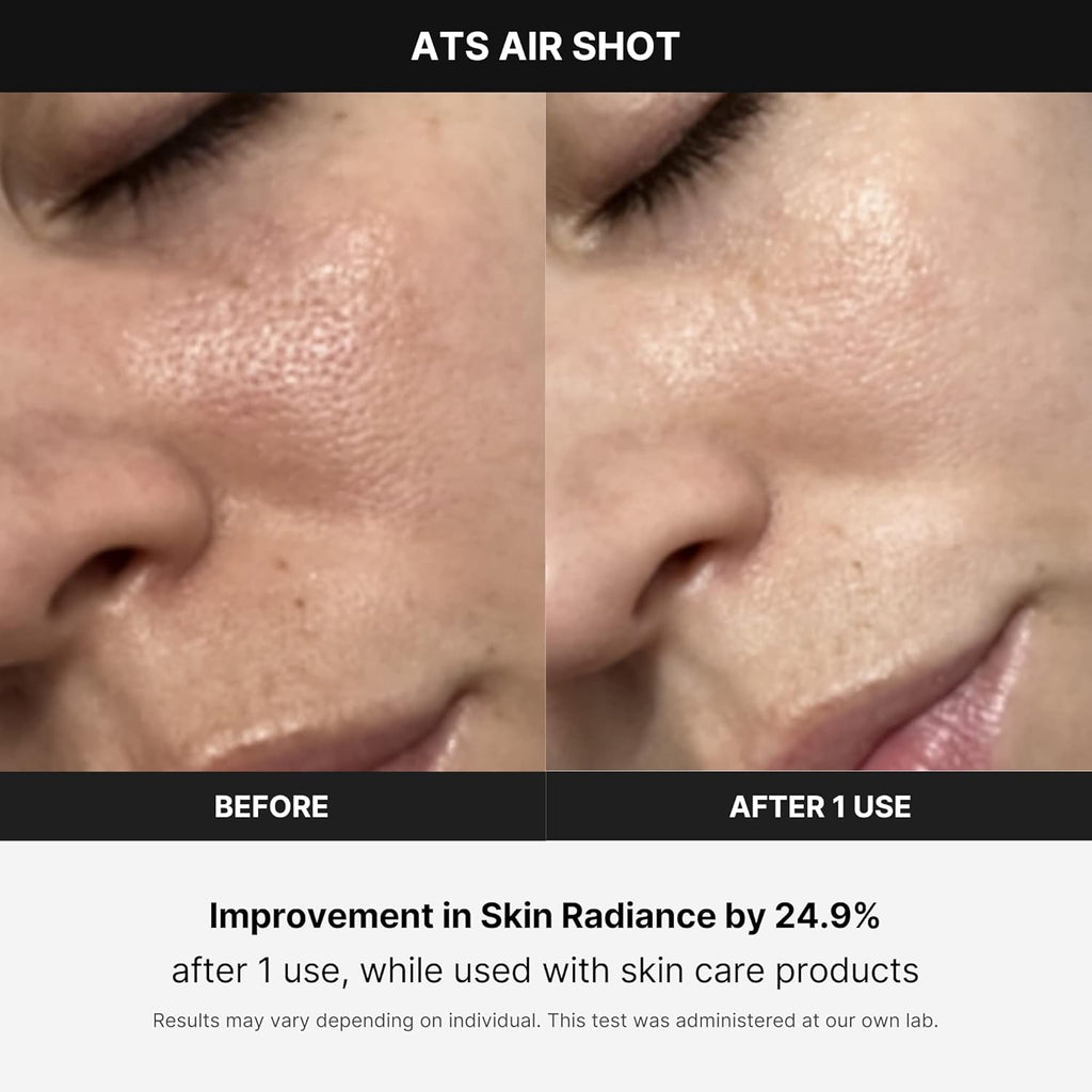 Medicube Age-R ATS Air Shot - Microneedling Pore Tightening Skin Care Device wourant