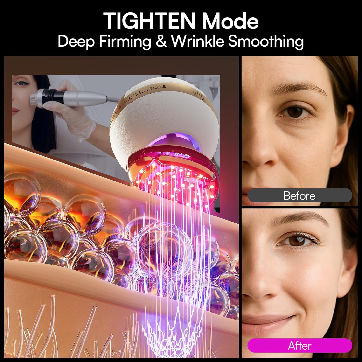INIA SPHERA Upgraded 8-in-1 Microcurrent Facial Device for Face & Neck Red Light wourant