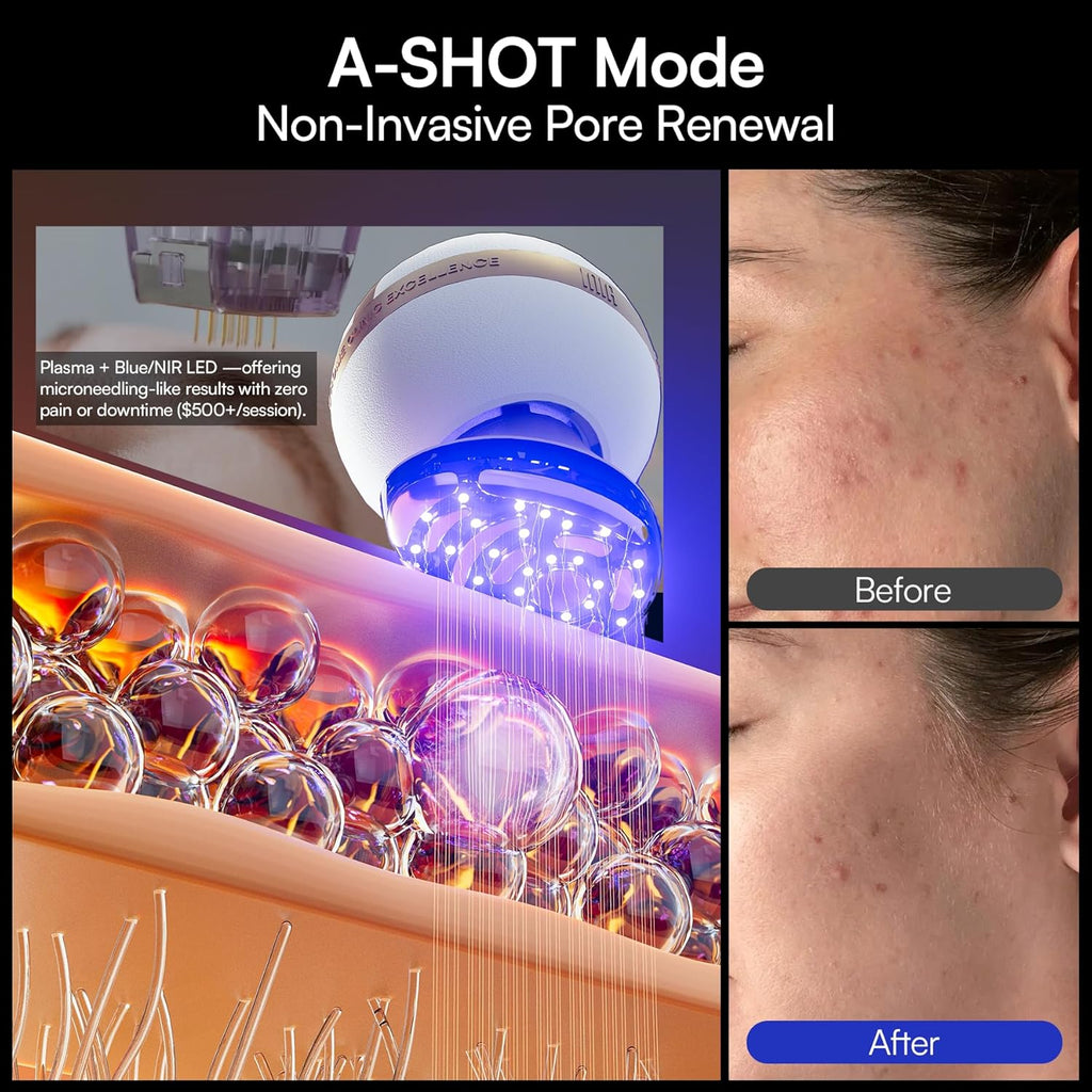 INIA SPHERA Upgraded 8-in-1 Microcurrent Facial Device for Face & Neck Red Light wourant